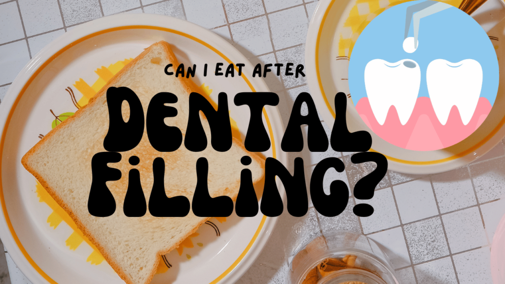 Can I Eat After a Dental Filling What to Know for Optimal Healing
