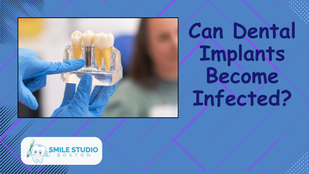 Can Dental Implants Become Infected