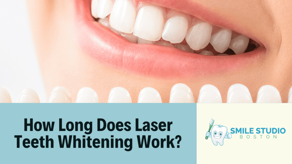 how long does laser teeth whitening work