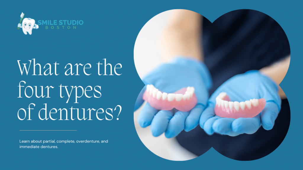 what are the four types of dentures