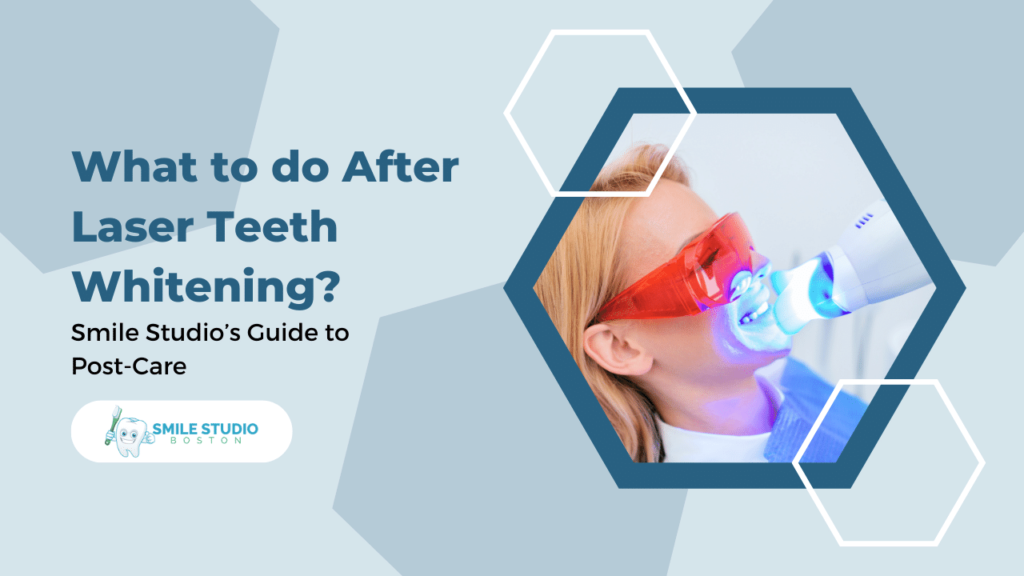 what to do after laser teeth whitening