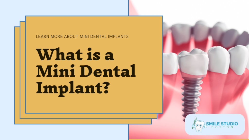 what is a mini dental implant