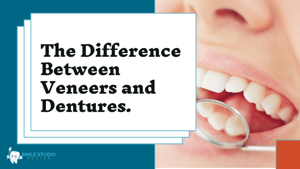 what is the difference between veneers and dentures