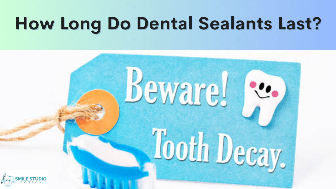 How long do dental sealants last