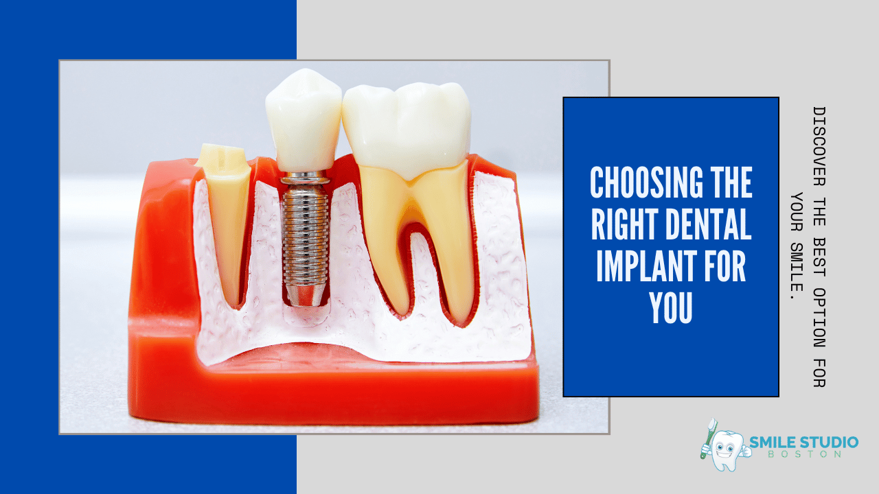 Different Types of Dental Implants: Which One is Right for You?