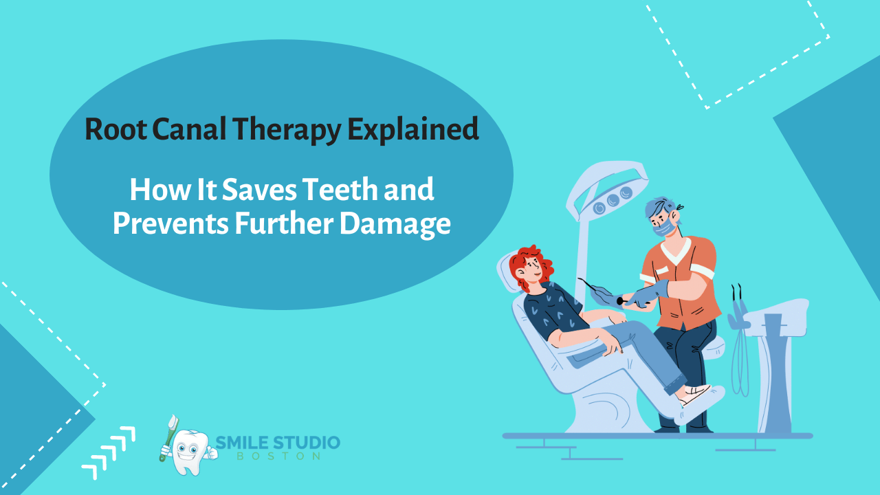 Root Canal Therapy Explained How It Saves Teeth and Prevents Further Damage