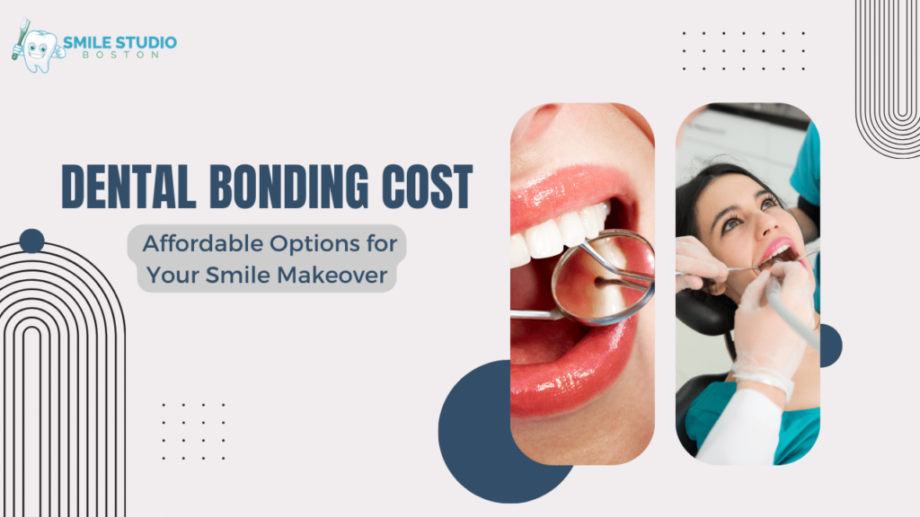 Dental Bonding Cost: Affordable Options for Your Smile Makeover