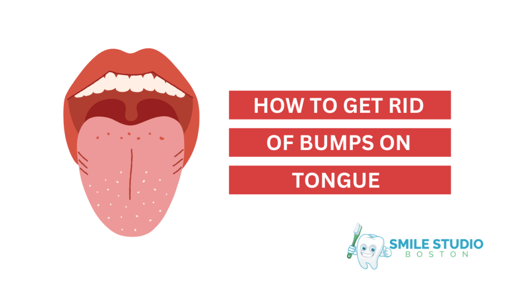 Your Guide on How to Get Rid of Bump on Tongue
