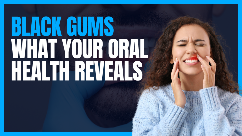 Black Gums: What Your Oral Health Reveals