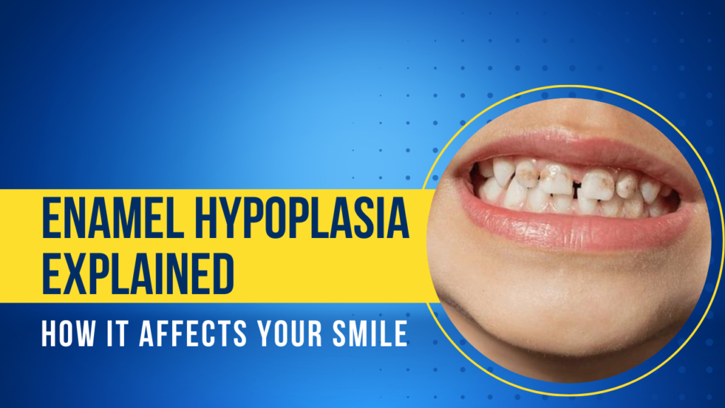 Enamel Hypoplasia Explained: How It Affects Your Smile