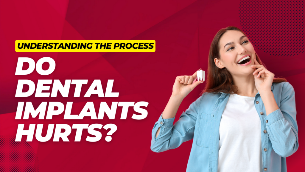 Understanding the Process: Do Dental Implants Hurt?