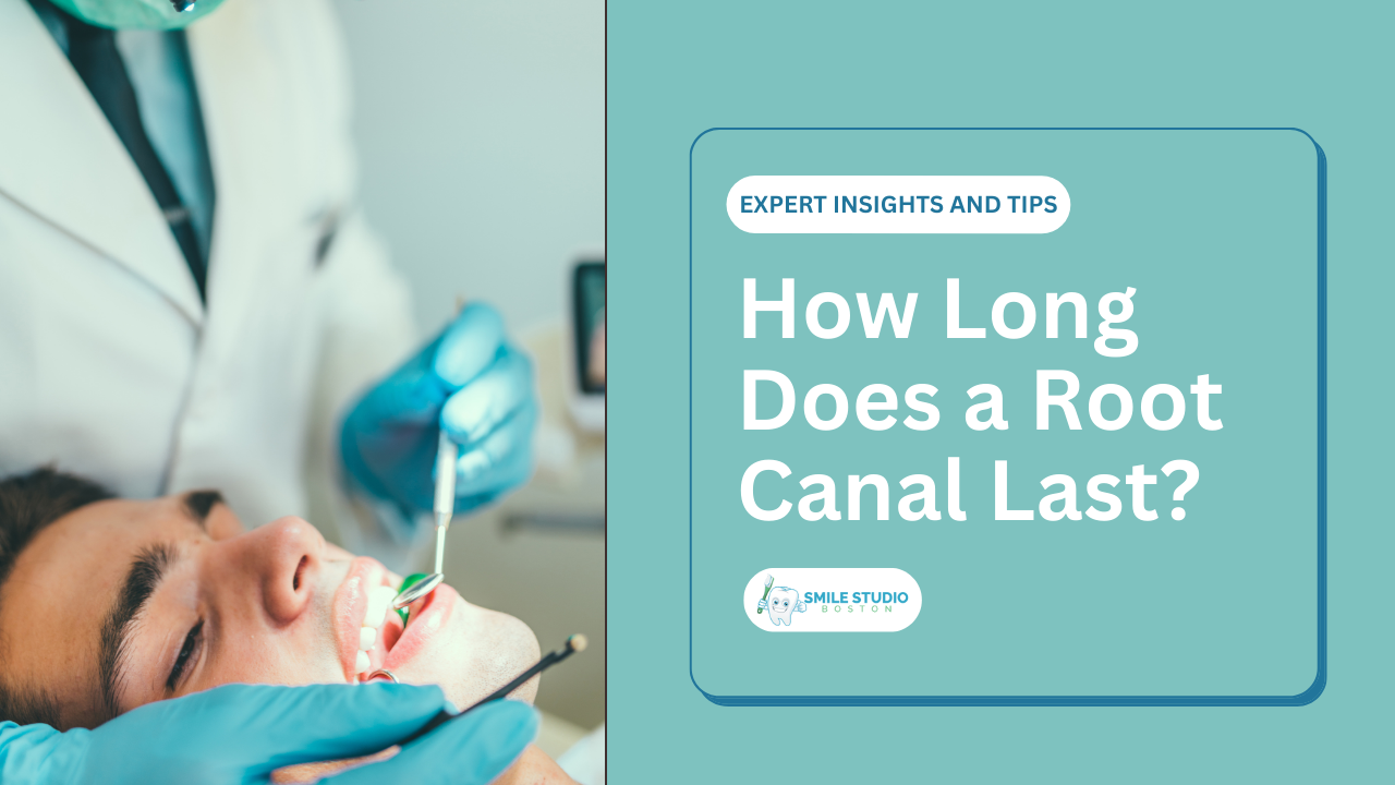 How Long Does a Root Canal Last: Expert Insights and Tips