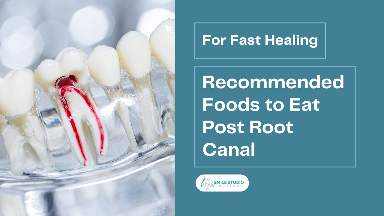 Recommended Foods to Eat Post Root Canal for Fast Healing