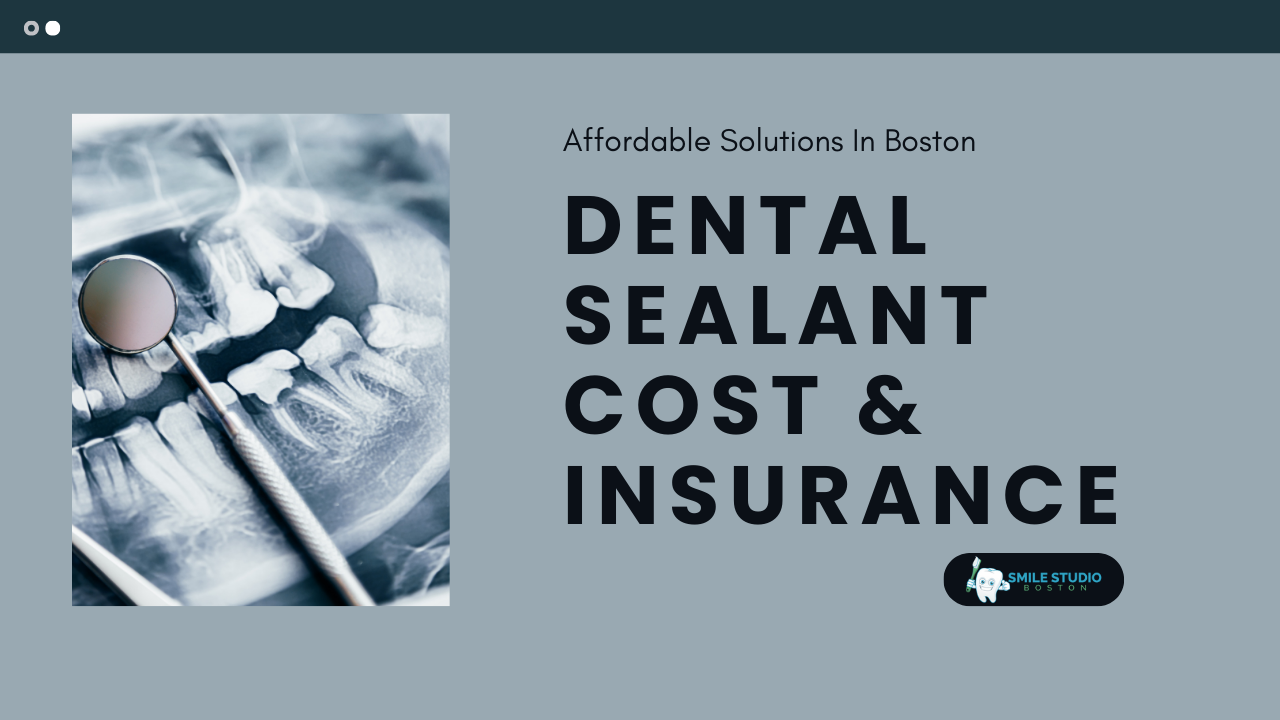 Dental Sealant Cost & Insurance in Boston Affordable Solutions (1)