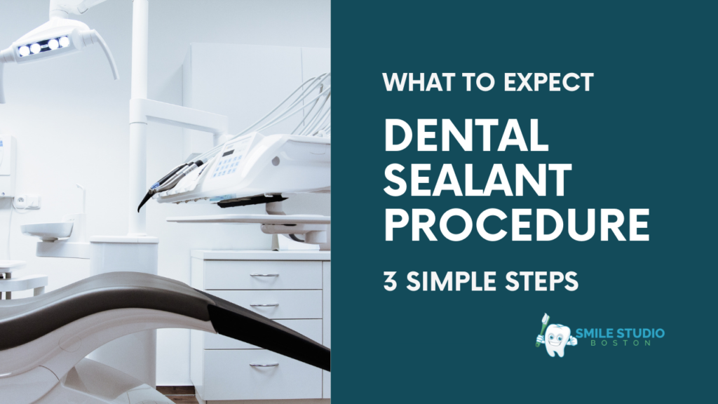 Dental Sealant Procedure in 3 Simple Steps What to Expect (1)