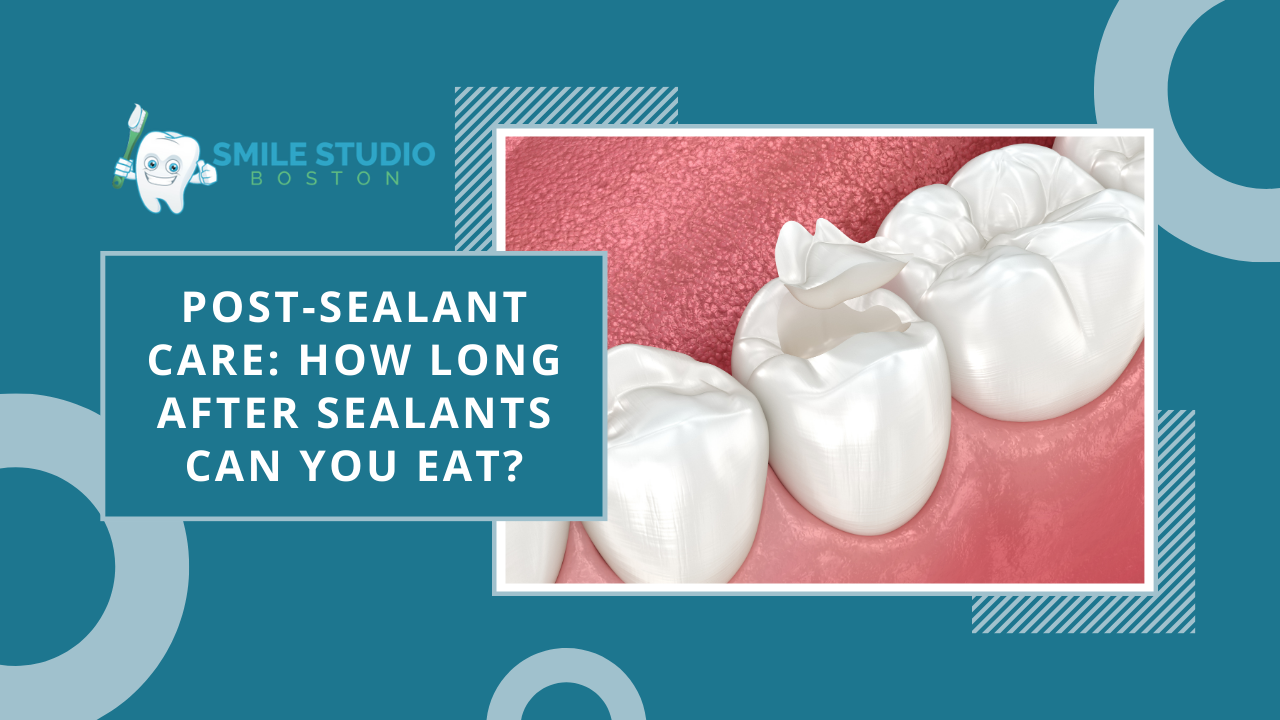 Post-Sealant Care: How Long After Sealants Can You Eat
