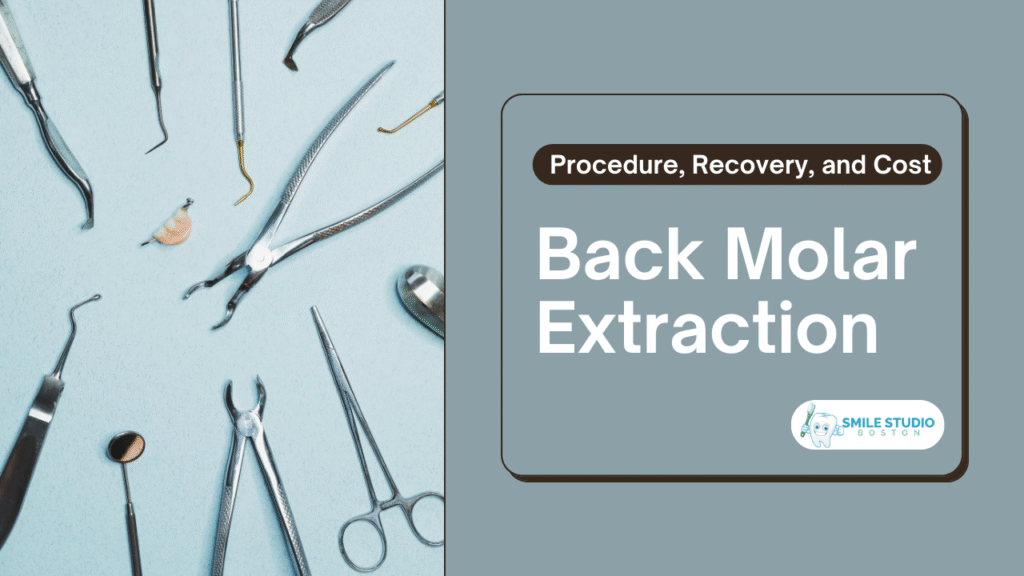 Back Molar Extraction Procedure, Recovery, and Cost