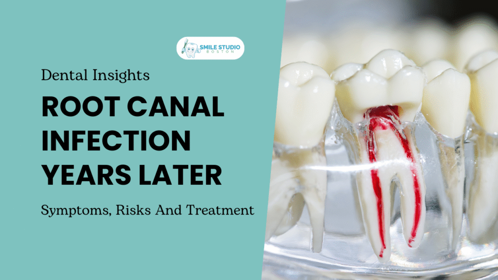 Root Canal Infection Years Later: Symptoms, Risks, and Treatment