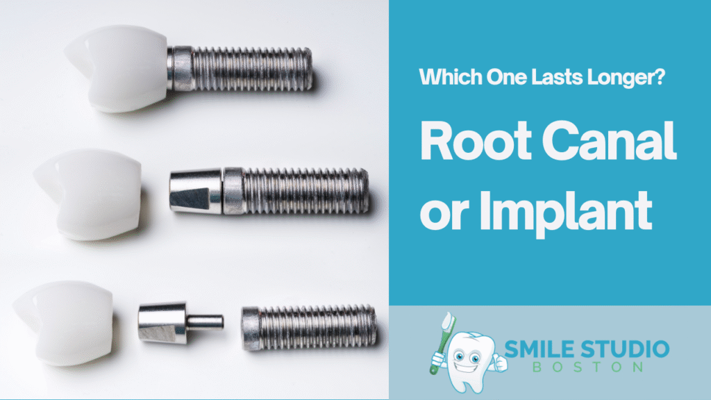 Root Canal or Implant – Which One Lasts Longer?