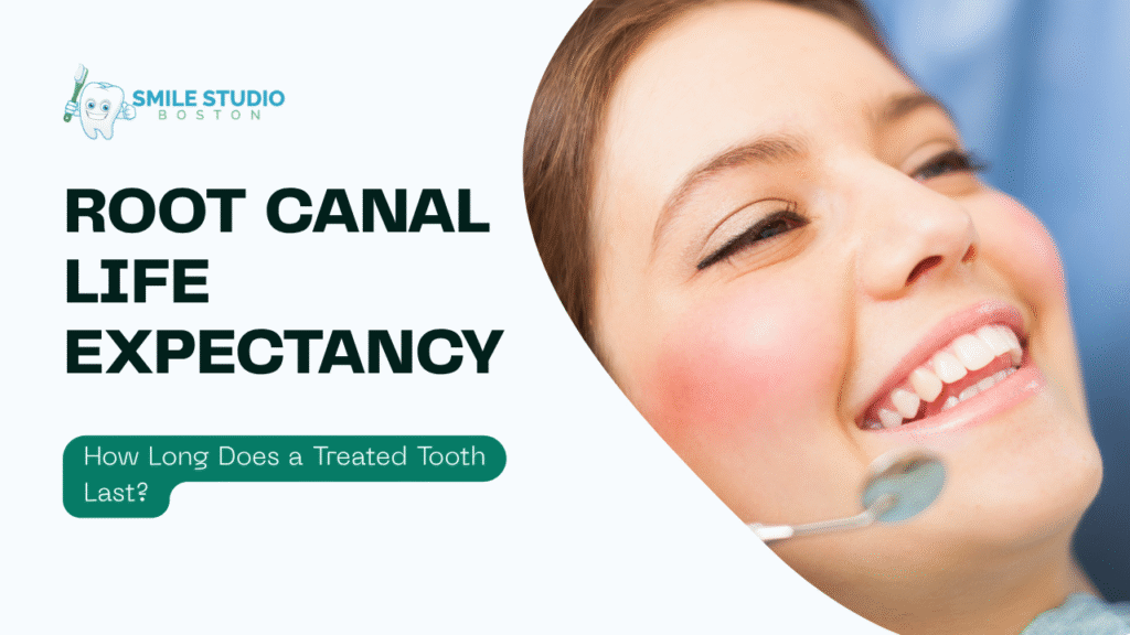 Root Canal Life Expectancy
