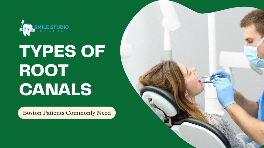 Types of Root Canals Boston Patients Commonly Need