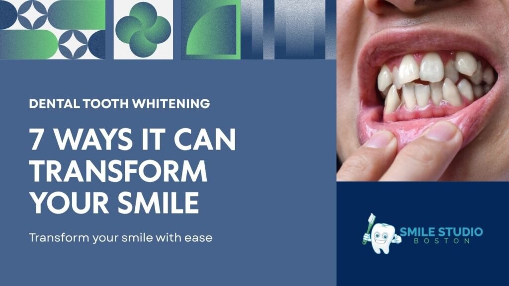 Dental Tooth Whitening: 7 Ways It Can Transform Your Smile