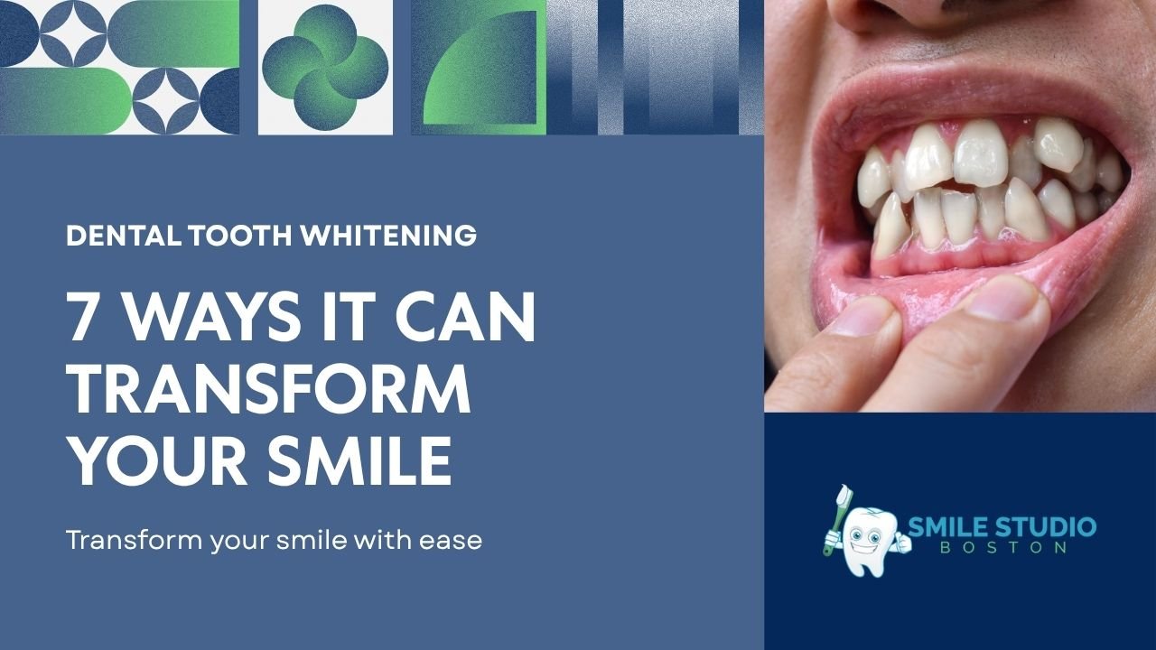 Dental Tooth Whitening: 7 Ways It Can Transform Your Smile