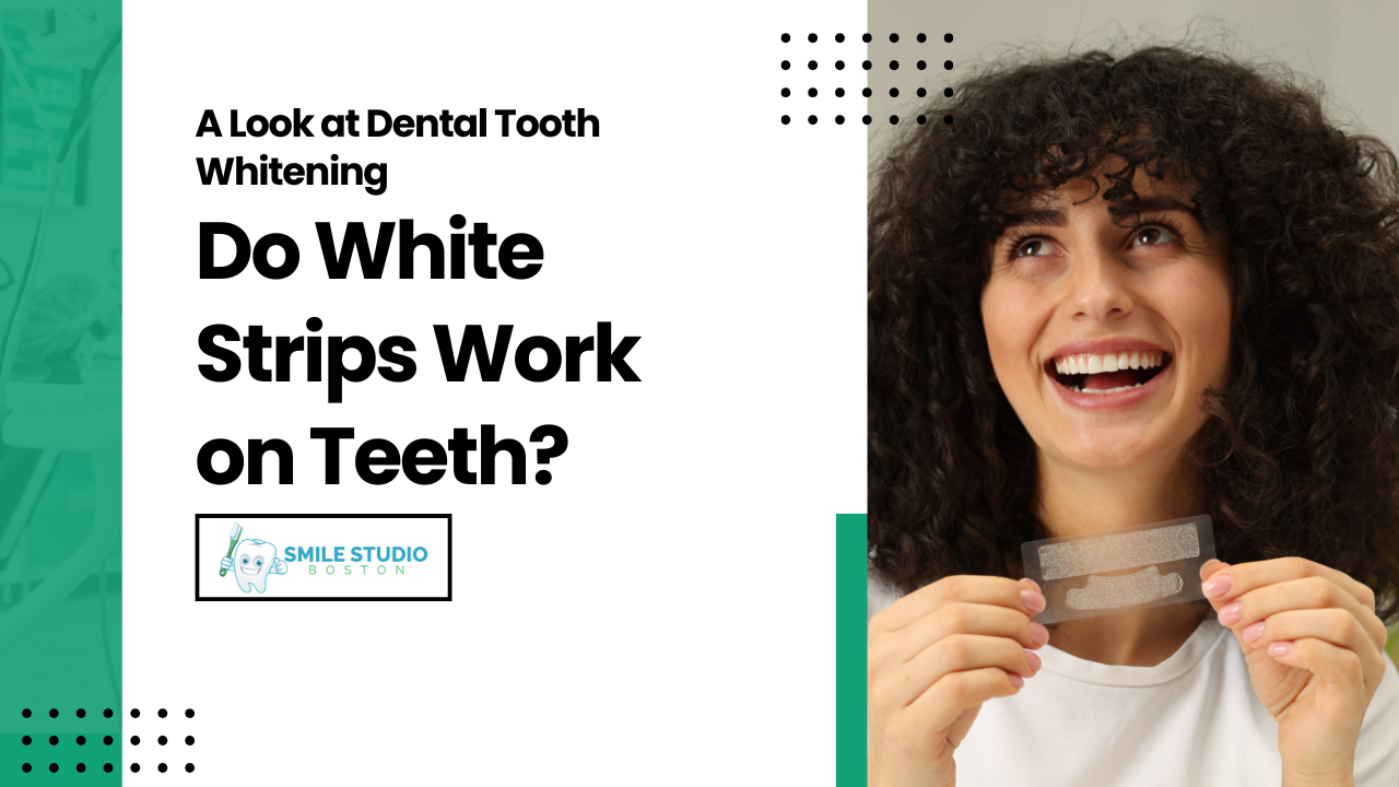 Do White Strips Work on Teeth? A Look at Dental Tooth Whitening