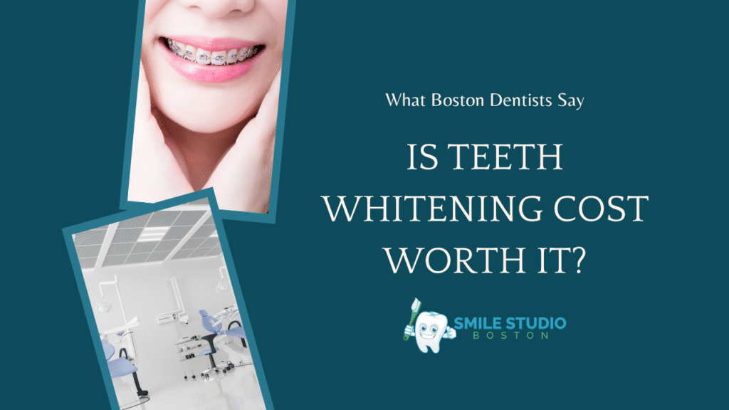 Is the Teeth Whitening Cost Worth It? What Boston Dentists Say