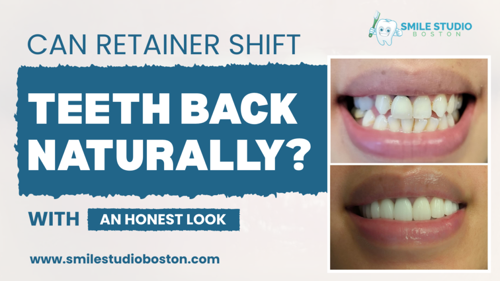 Can Retainer Shift Teeth Back Naturally? An Honest Look