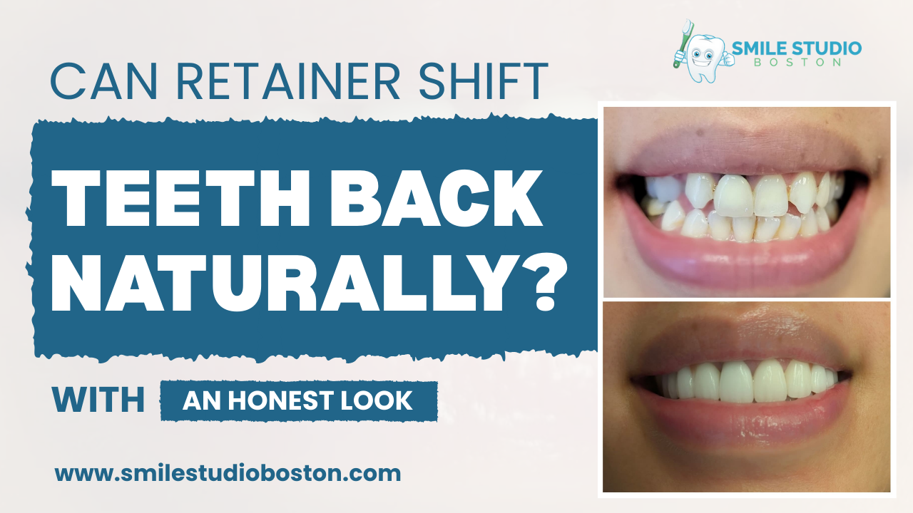 Can Retainer Shift Teeth Back Naturally? An Honest Look