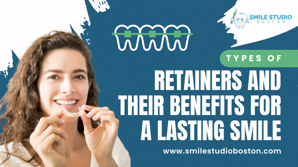 Types of Retainers and Their Benefits