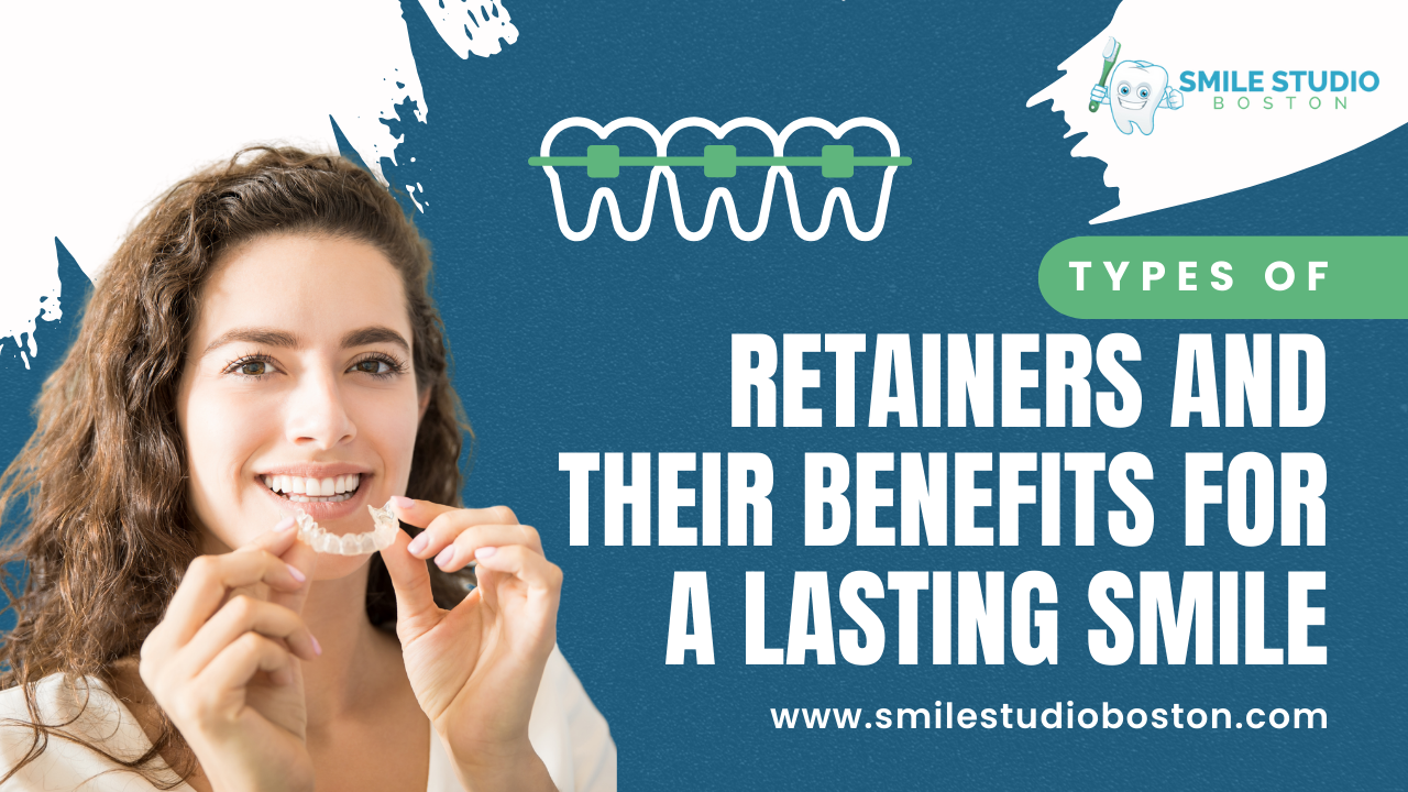 Types of Retainers and Their Benefits